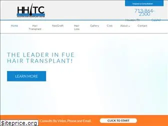 houstonhairtransplant.com
