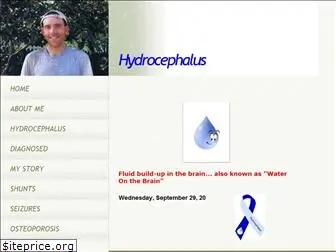 hydrocephalus.yolasite.com