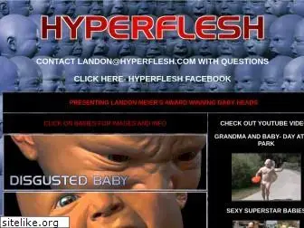 hyperflesh.com
