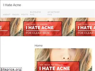 ihateacne.net