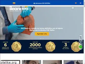 ileanovo.com