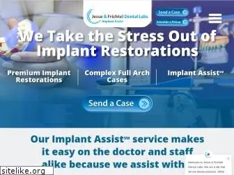 implant-assist.com