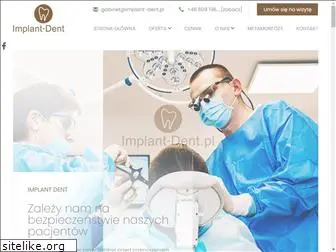 implant-dent.pl