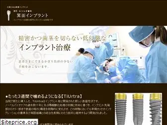 implant-exosaka.com