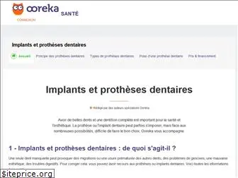 implant-prothese-dentaire.comprendrechoisir.com