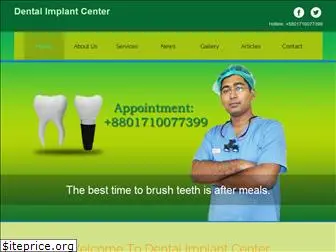 implant.com.bd