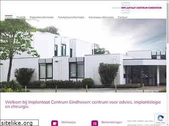implantaatcentrumeindhoven.nl