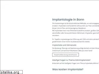 implantat-zahnarzt-bonn.de