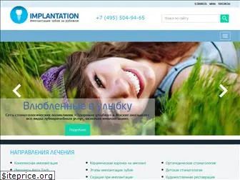 implantation.ru