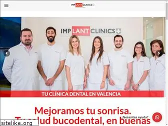 implantclinics.es