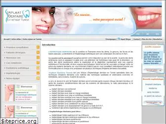 implantdentairetunisie.com