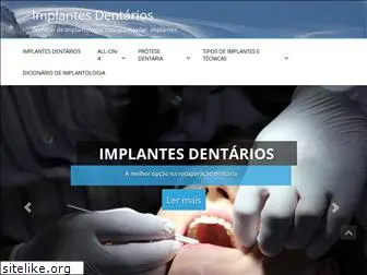 implante-dentario.pt