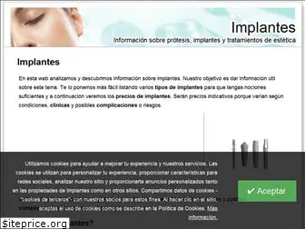 implante.org.es