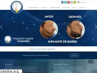 implantecapilar.com.co