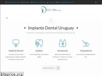 implantedentaluruguay.com