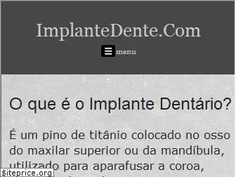 implantedente.com