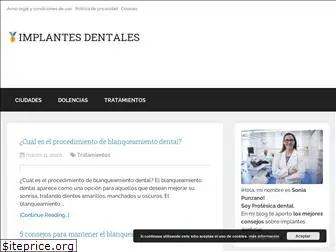 implantes-dentales.online