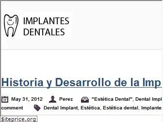 implantesdentalesvalencia.es