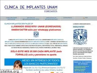 implantesnacionales.com.mx