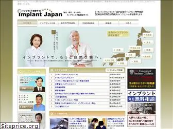 implantjapan.net