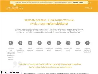 implantkrakow.pl
