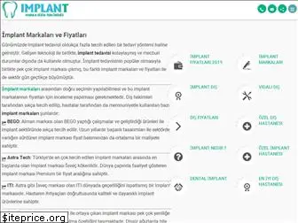 implantmarkalari.net