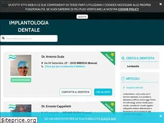 implantologiadentalebrescia.com