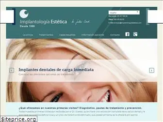 implantologiaestetica.com