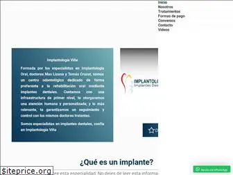 implantologiavina.cl