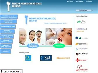 implantologie-info.cz