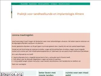 implantologiealmere.nl