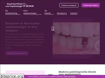 implantologiegrave.nl