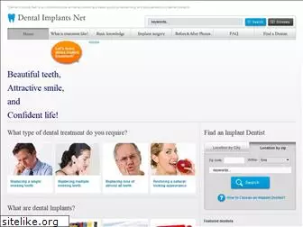 implants-dental.org