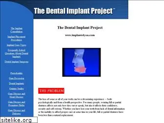 implants4you.com