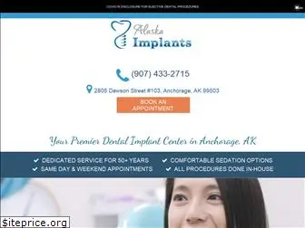implantsalaska.com