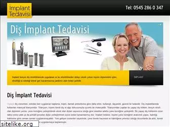 implanttedavisi.net