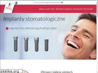 implanty-bieleccy.pl