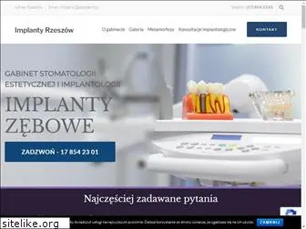 implanty24h.rzeszow.pl