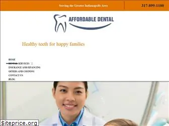 indyaffordabledental.com