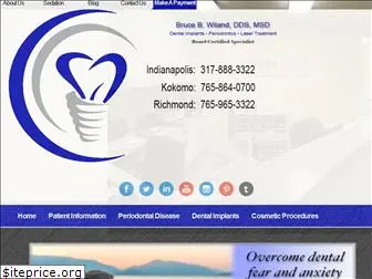 indyperio.com