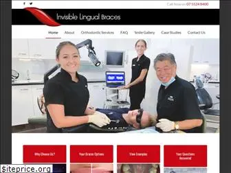 invisiblelingualbraces.com.au