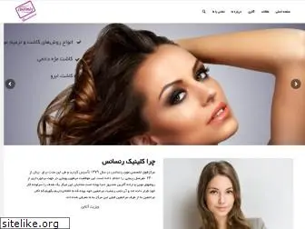 iranivs.com