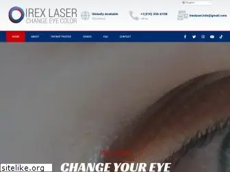 irexlaser.com