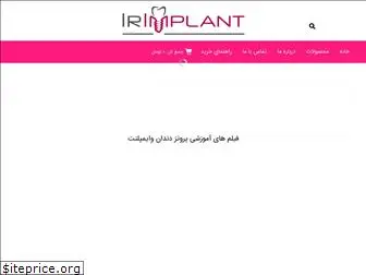 irimplant.com