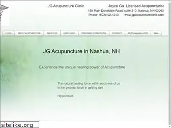 jgacupunctureclinic.com