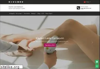 kayserilazerepilasyon.com