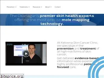 kelownaskincancer.com