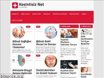 kesintisiznet.com