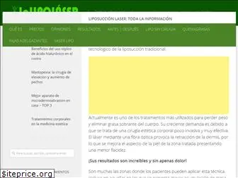 lalipolaser.net