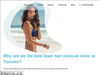 laser4less.com